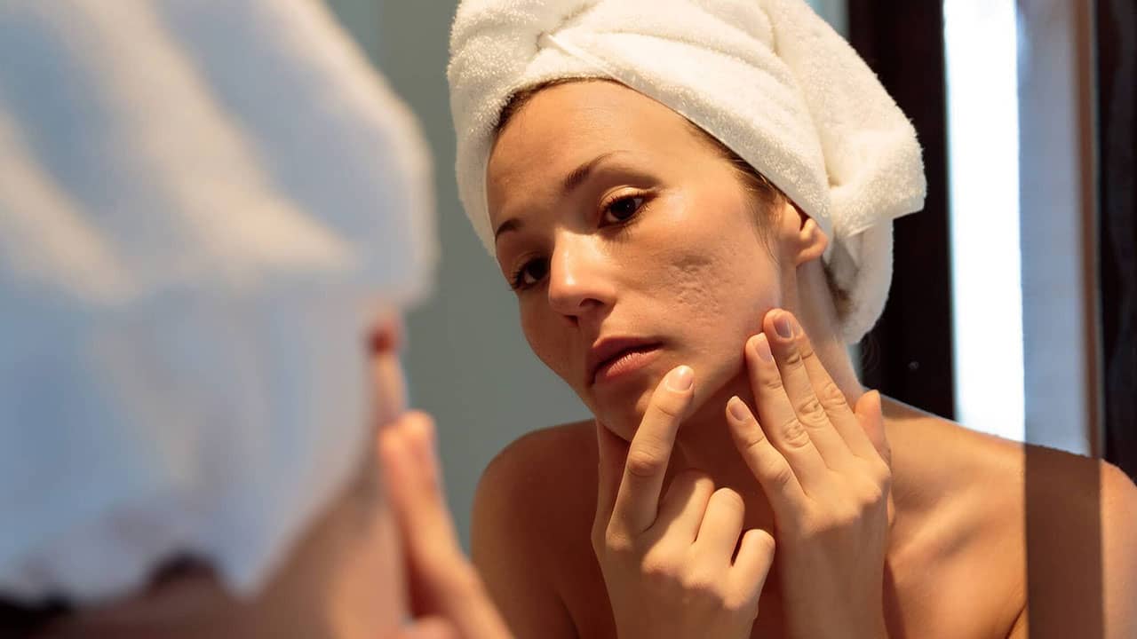 Peels for every skin concern USA in 2025
