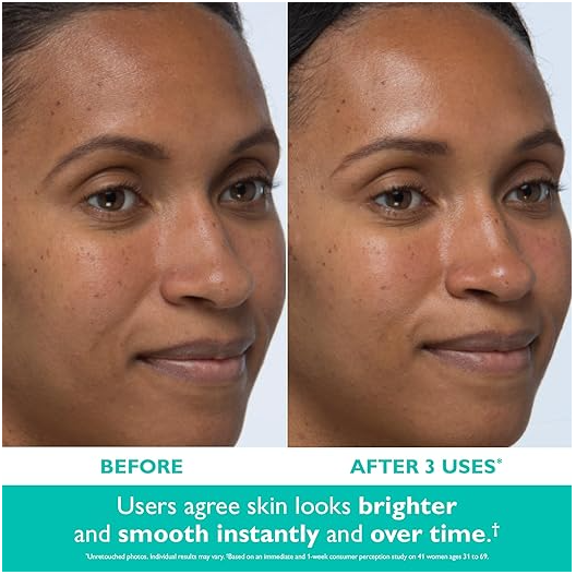 image from Amazon's Peter Thomas Roth Official store. Peter Thomas Roth photo peels before and after 3 uses