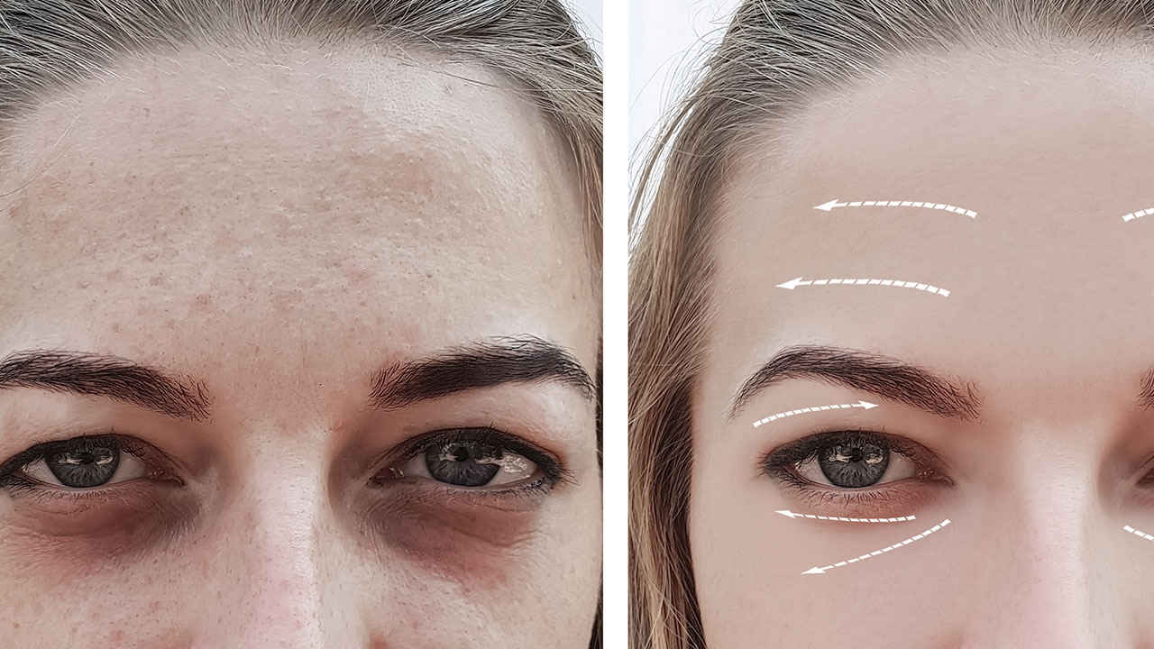 The vitalize peel: everything you need to know