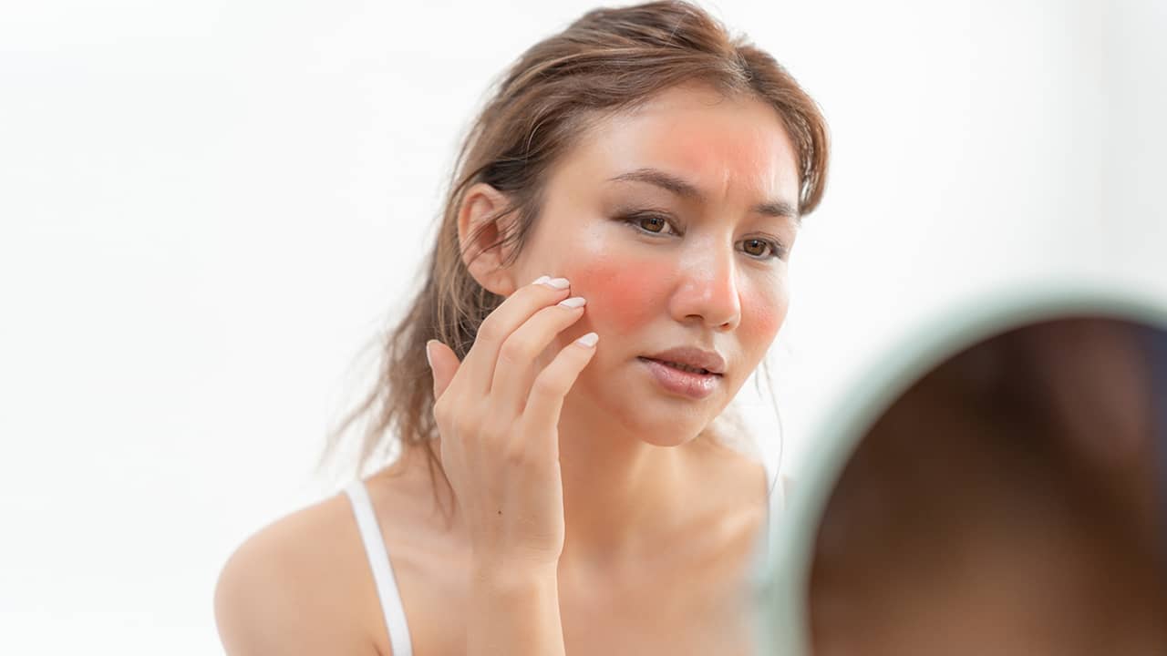 chemical peel for sensitive skin : 5 best products for a radiant glow